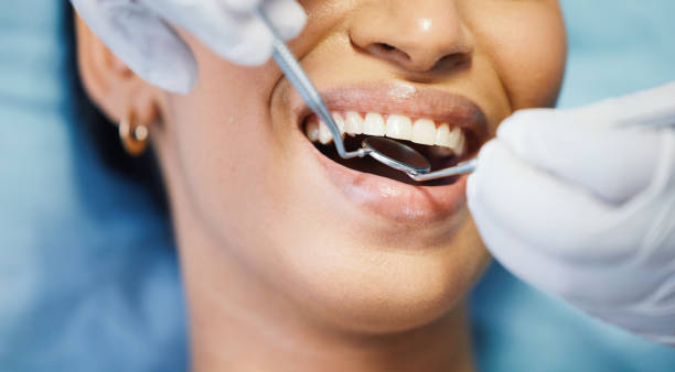 Best Emergency Wisdom Teeth Removal in Tyrone, GA